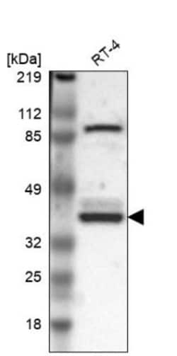 WDR89 Antibody, Novus Biologicals 0.1mL; Unlabeled:Antibodies, Polyclonal